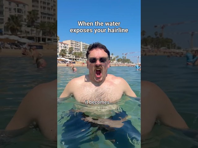When the water exposes your hairline 🌊👀 #comedy #sketch #Couple #hairline #relatable #holiday