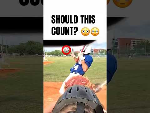hit by pitch? 😳